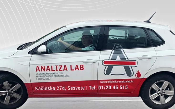 Vozilo Poliklinike Analiza Lab za kućne posjete