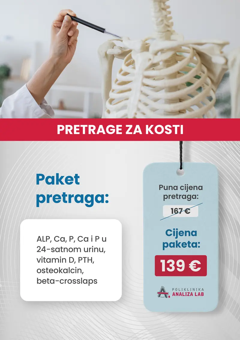 Poster paketa: Pretrage za kosti