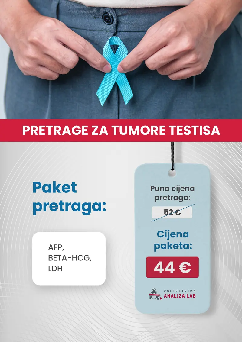 Poster paketa: Pretrage za tumore testisa