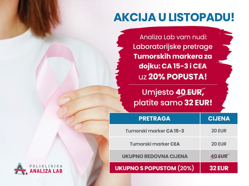 Analiza-AKCIJA-Listopad_TABLET.jpg